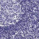 AAK1 Antibody in Immunohistochemistry (Paraffin) (IHC (P))