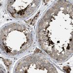HIP1 Antibody in Immunohistochemistry (Paraffin) (IHC (P))