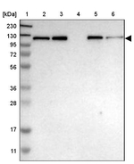 HIP1 Antibody in Western Blot (WB)