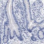ATP6V0A4 Antibody in Immunohistochemistry (Paraffin) (IHC (P))