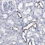 ATP6V0A4 Antibody in Immunohistochemistry (Paraffin) (IHC (P))