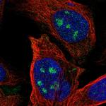 ZNF71 Polyclonal Antibody