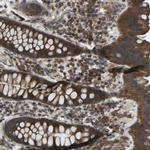ZNF71 Antibody in Immunohistochemistry (Paraffin) (IHC (P))