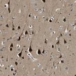 RNF141 Antibody in Immunohistochemistry (Paraffin) (IHC (P))