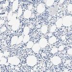 GOT2 Antibody in Immunohistochemistry (Paraffin) (IHC (P))