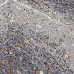 GOT2 Antibody in Immunohistochemistry (Paraffin) (IHC (P))