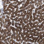 GOT2 Antibody in Immunohistochemistry (Paraffin) (IHC (P))
