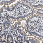 GOT2 Antibody in Immunohistochemistry (Paraffin) (IHC (P))