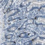 RRP1 Antibody in Immunohistochemistry (Paraffin) (IHC (P))