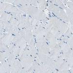 RRP1 Antibody in Immunohistochemistry (Paraffin) (IHC (P))