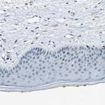 RRP1 Antibody in Immunohistochemistry (Paraffin) (IHC (P))