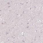 SIGLEC6 Antibody in Immunohistochemistry (Paraffin) (IHC (P))