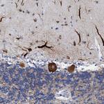 DUSP26 Antibody in Immunohistochemistry (Paraffin) (IHC (P))