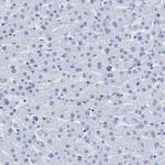 DUSP26 Antibody in Immunohistochemistry (Paraffin) (IHC (P))
