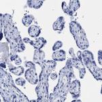 DUSP26 Antibody in Immunohistochemistry (Paraffin) (IHC (P))