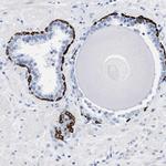 DUSP26 Antibody in Immunohistochemistry (Paraffin) (IHC (P))