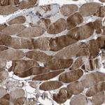 USP25 Polyclonal Antibody