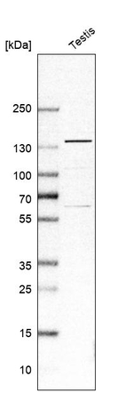 USP25 Antibody in Western Blot (WB)