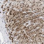 NUP35 Polyclonal Antibody