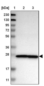NUP35 Antibody in Western Blot (WB)