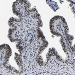 POLDIP3 Antibody in Immunohistochemistry (Paraffin) (IHC (P))