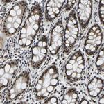 POLDIP3 Antibody in Immunohistochemistry (Paraffin) (IHC (P))