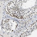 POLDIP3 Antibody in Immunohistochemistry (Paraffin) (IHC (P))
