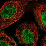 NUP35 Polyclonal Antibody