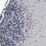NUP35 Antibody in Immunohistochemistry (Paraffin) (IHC (P))