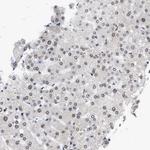 NUP35 Antibody in Immunohistochemistry (Paraffin) (IHC (P))