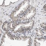 NUP35 Antibody in Immunohistochemistry (Paraffin) (IHC (P))