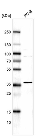 NUP35 Antibody in Western Blot (WB)