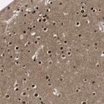 ZNF346 Antibody in Immunohistochemistry (Paraffin) (IHC (P))