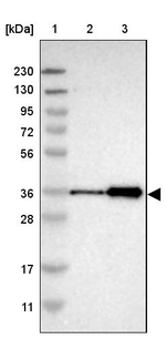 ZNF346 Antibody in Western Blot (WB)