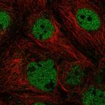 BAF53A Polyclonal Antibody