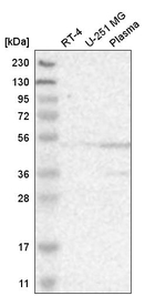 BAF53A Antibody in Western Blot (WB)