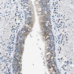 ZDHHC13 Antibody in Immunohistochemistry (Paraffin) (IHC (P))