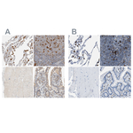 CAPG Polyclonal Antibody