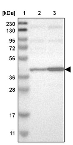 CAPG Antibody in Western Blot (WB)