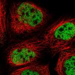 FOXK1 Polyclonal Antibody