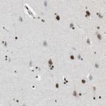 FOXK1 Antibody in Immunohistochemistry (Paraffin) (IHC (P))