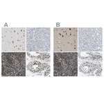 FOXK1 Antibody in Immunohistochemistry (Paraffin) (IHC (P))