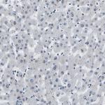 FOXK1 Antibody in Immunohistochemistry (Paraffin) (IHC (P))