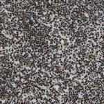 FOXK1 Antibody in Immunohistochemistry (Paraffin) (IHC (P))