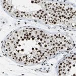 FOXK1 Antibody in Immunohistochemistry (Paraffin) (IHC (P))