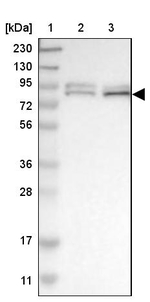 FOXK1 Antibody in Western Blot (WB)