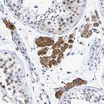 PDI Antibody in Immunohistochemistry (Paraffin) (IHC (P))