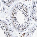 PDI Antibody in Immunohistochemistry (Paraffin) (IHC (P))