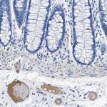 Apolipoprotein L1 Antibody in Immunohistochemistry (Paraffin) (IHC (P))