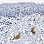 Apolipoprotein L1 Antibody in Immunohistochemistry (Paraffin) (IHC (P))